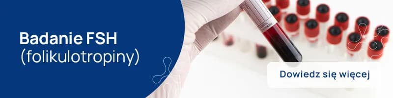 Kiedy badać FSH? Kluczowe informacje dla zdrowia hormonalnego